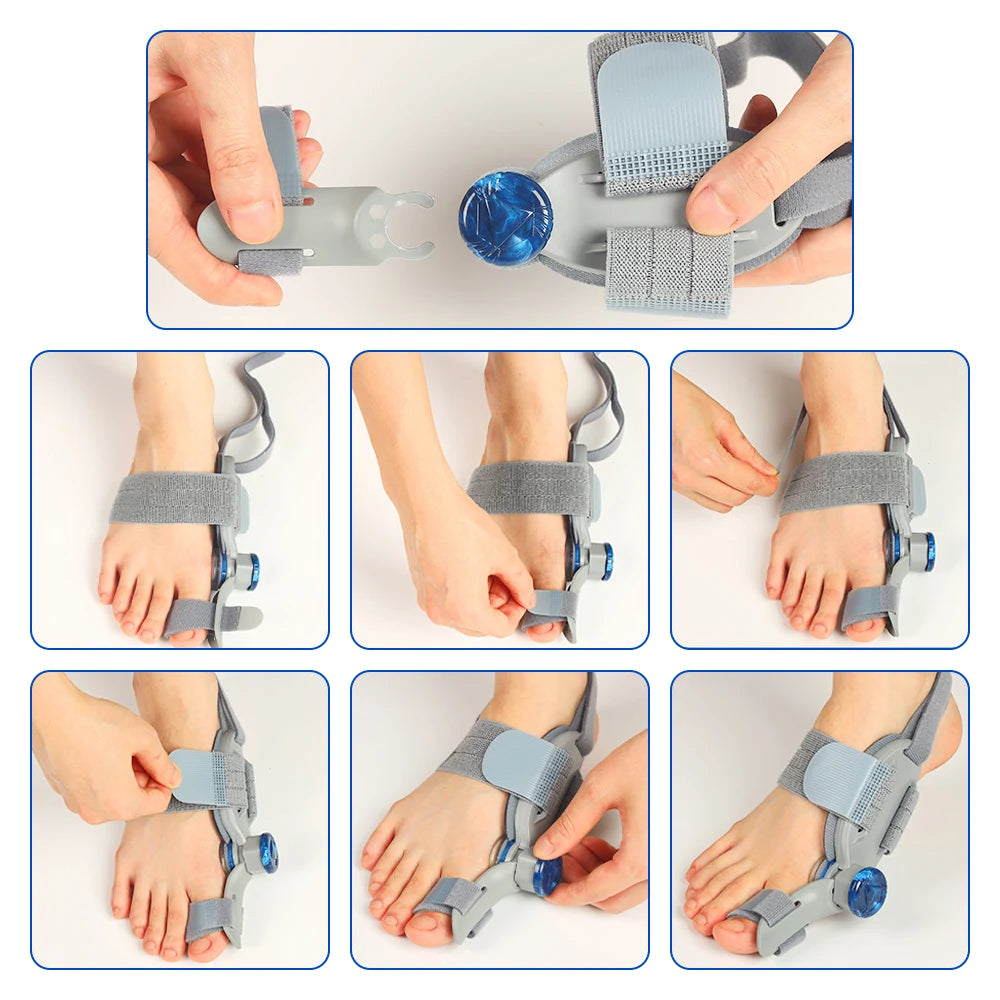 Moajaza Adjustable Bunion Toe Straightener